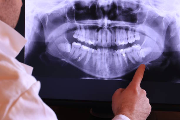 Best Emergency Dentist for Knocked-Out Tooth in Nambe, NM