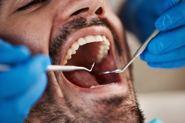 Best Emergency Dentist for Special Needs Patients in Nambe, NM