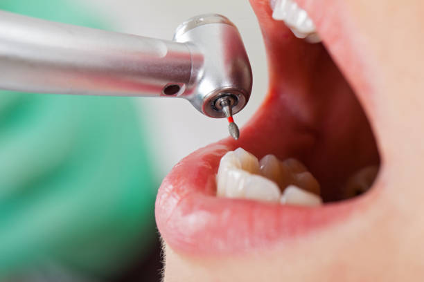 Best Broken or Cracked Tooth Emergency Dentist in Nambe, NM